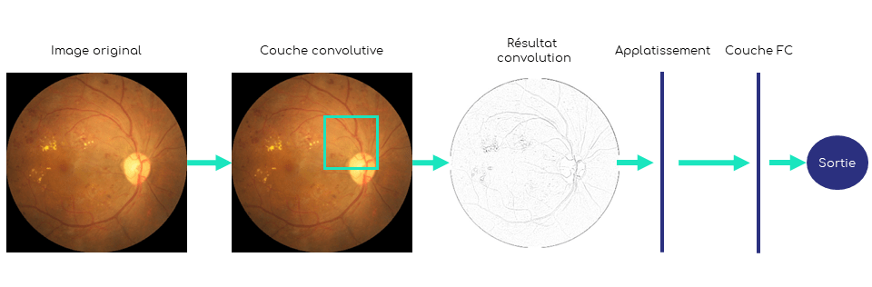 Imagerie médicale : Architecture des réseaux neuronaux pour la classification d'images